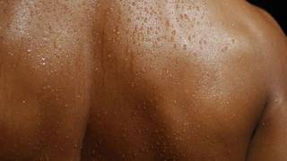 Embarrassing Problem  Excess Sweating  Ayurveda  Dr Sumita Prajapati [upl. by Wendell]