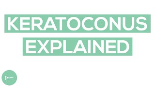 Keratoconus Explained  What Is Keratoconus and How Does It Impact Vision [upl. by Miarhpe141]