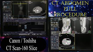 CT Scan of Abdomen Full Procedure basicradiology [upl. by Adnoral]