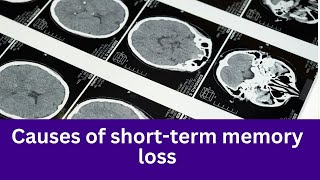 short term memory loss symptoms and causes shorttermmemory [upl. by Nalek]