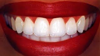 Teeth Whitening At Home In 3 Minutes  How To Whiten Your Yellow Teeth Naturally  100 Effective [upl. by Ruvolo]