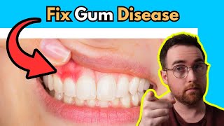 Do THIS to fix Gum Disease [upl. by Dietz]