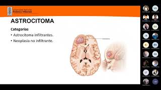 21 Neoplasias del SNC Astrocitomas oligodendrogliomas y ependimomas [upl. by Ailerua793]