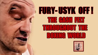 Tyson Fury vs Oleksandr Usyk Postponed  Quick Thoughts on the Cut [upl. by Sisto]