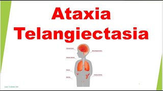 Ataxia Telangiectasia  Immunology USMLE Step 1 [upl. by Haibot]