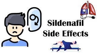 Sildenafil Viagra  Side Effects [upl. by Anayi671]