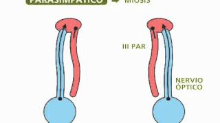 Reflejos pupilares  Oftalmología [upl. by Mosora879]