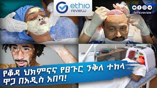 የቆዳ ህክምና እና የፀጉር ንቅለ ተከላ ዋጋ በአዲስ አበባ Dermatology and Hair Transplant Service Addis Ababa Ethiopia [upl. by Llig]