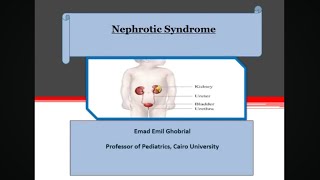 Nephrotic presentation Prof Emad Emil Prof of Pediatrics and Pediatric Nephrology [upl. by Bobseine786]