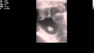 Ultrasound of a 26 day equine pregnancy [upl. by Aikam]