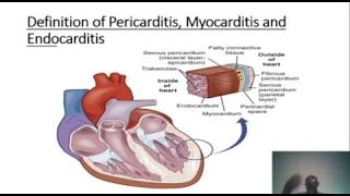 LEARN ABOUT PERICARDITIS MYOCARDITIS AND ENDOCARDITIS [upl. by Kevina]