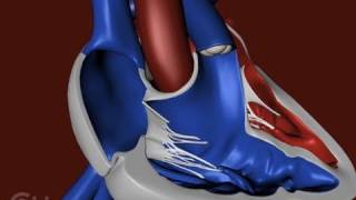 The Structure of a Heart with Tetralogy of Fallot TOF  The Childrens Hospital of Philadelphia [upl. by Rabaj756]