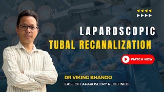 Lap Tubal Recanalization  Under SA BL Pyosalpinx [upl. by Eniluqaj]