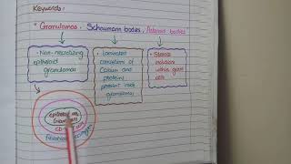 Sarcoidosis Histopathology  Granulomas Schaumann bodies Asteroid bodies [upl. by Burnsed]