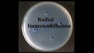 Radial immunodiffusion Teaching kit [upl. by Daisie785]