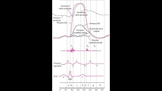 DIU CPC 2021 Cathétérisme cardiaque diagnostique par François Godart [upl. by Nekal]