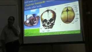 1 DrSherif Zaki 12102014  Skull  Norma Verticalis  Occipitalis [upl. by Ananna]