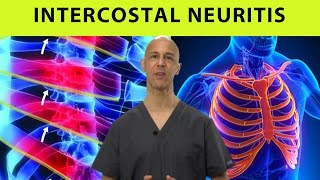 Intercostal Neuritis Relief Mid Back Pain Rib amp Chest Pain  Dr Mandell [upl. by Eanar]