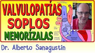 Memoriza las VALVULOPATÍAS y SOPLOS ✅ rápido y fácil [upl. by Nizam]