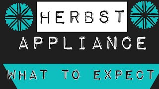 Getting a Herbst Appliance [upl. by Oiramal]