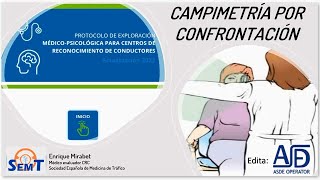 Método de Campimetría por Confrontación [upl. by Ailido]