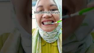 Interdental brush untuk behel [upl. by Atteve666]