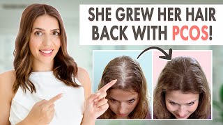 How Stephanie Grew Her Hair Back  Her PCOS Hair Loss Journey amp Treatment [upl. by Eradis]