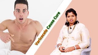 VARICOCELE CAUSES AND CURE  DrBYogavidhya Ethnic health care 2018 English [upl. by Ardie]