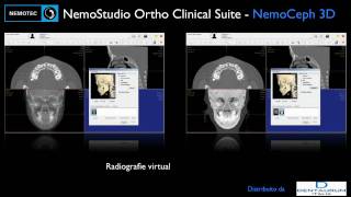 NemoStudio Ortho Clinical Suite [upl. by Narak]