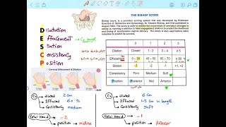 BISHOP SCORE Mnemonic Normal Labor [upl. by Ael747]