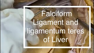 Peritoneum Falciform ligament Ligamentum teres of Liver [upl. by Ause]