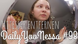 Mitesser entfernen  DailyYooNessa 98  YooNessa [upl. by Wilow]