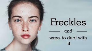 How to treat freckles using homeopathy [upl. by Lanor]