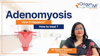 Adenomyosis  How it happens How to treat  English [upl. by Gunar305]