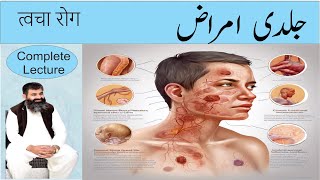 SKIN DISEASES  Causes amp treatment of SKIN DISEASES  Homeopathic DRMMUNAWAR DAWOOD [upl. by Eeladnerb]