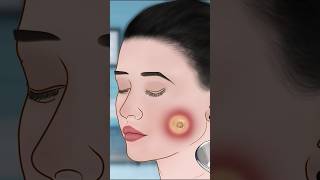 ASMR Dimple piercing infection treatment P2asmr animation satisfying trending shorts [upl. by Aneek679]