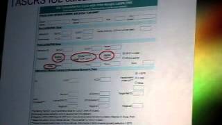 Rethinking corneal astigmatism and toric IOL selection by Dr Douglas D Koch [upl. by Consolata]