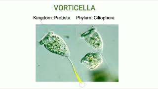 Phylum Ciliophora  Vorticella [upl. by Audrey]