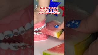 5 FOODS to AVOID if you just got BRACES put ON braces foodasmr satisfying [upl. by Neall782]