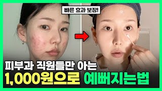 피부과 보습관리 원가 공개 이 방법이면 내일 당장 피부 좋아집니다 ㅣ여드름 좁쌀 유수분 밸런스 다 잡는 법 [upl. by Neufer960]