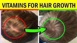 10 Best Vitamins and Supplements for Hair Growth  Grow THIN Hair into THICK Hair [upl. by Cosmo]