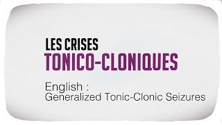 Generalized Tonic Clonic Seizures [upl. by Hsakiv986]