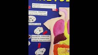 Lifecycle of Entamoeba histolytica [upl. by Eislehc]