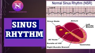 NORMAL SINUS RHYTHM EKG ECG INTERPRETATION [upl. by Uhthna]