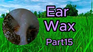 ear wax removal asmr roleplay [upl. by Kelula]