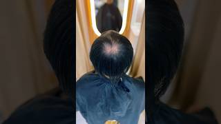 Hair lose no problem with hair toupee replacement instant pogi toupee viralvideo haircut [upl. by Strohbehn420]