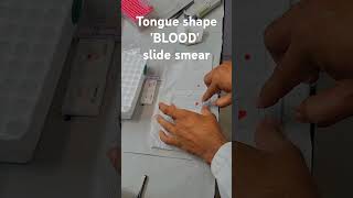 BLOOD SMEAR science medicallaboratory pathology laboratorytechniques science laboratorylife [upl. by Sugna890]