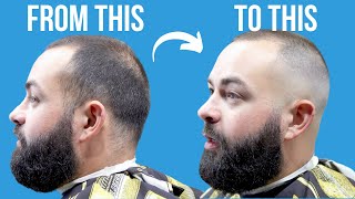 HOW TO FADE THINNING HAIR  MULTIPLE HAIR TEXTURES [upl. by Eednac]