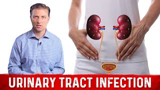 Best Home Remedy for Urinary Tract Infection UTI – Dr Berg [upl. by Llerrah]