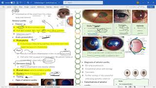 Ophthalmology 4  Uveitis amp optic neuritis [upl. by Eraste30]